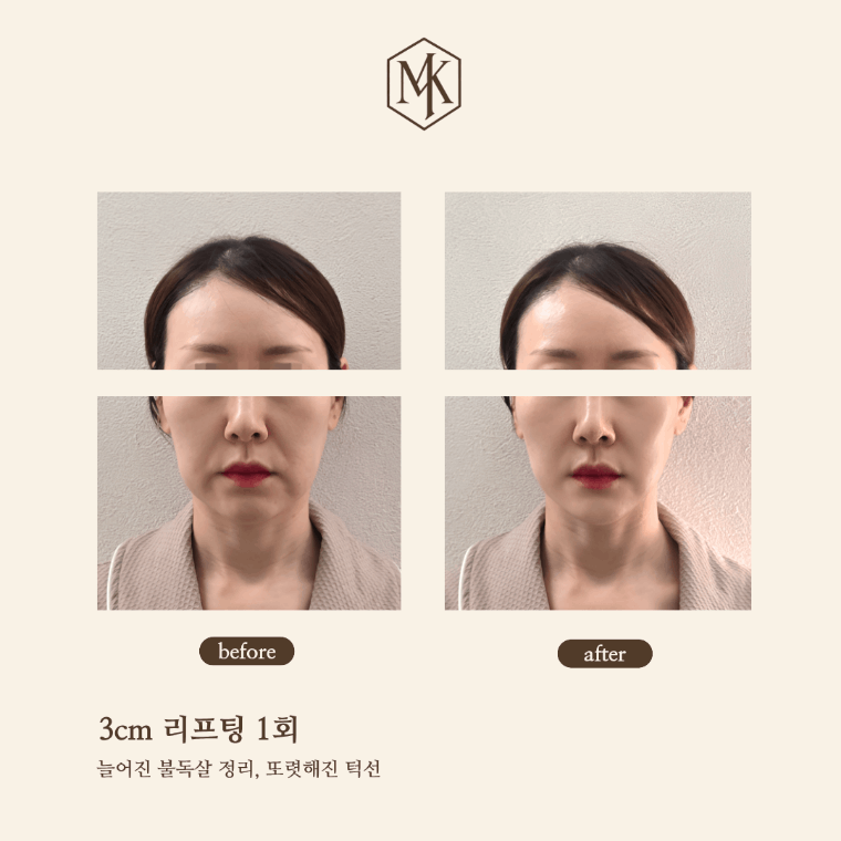 엠케이에스테틱