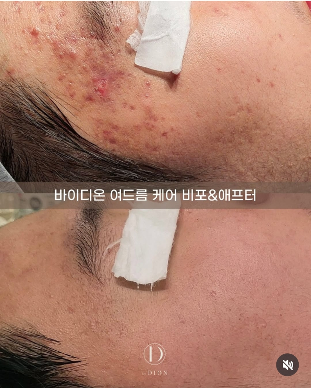 바이디온